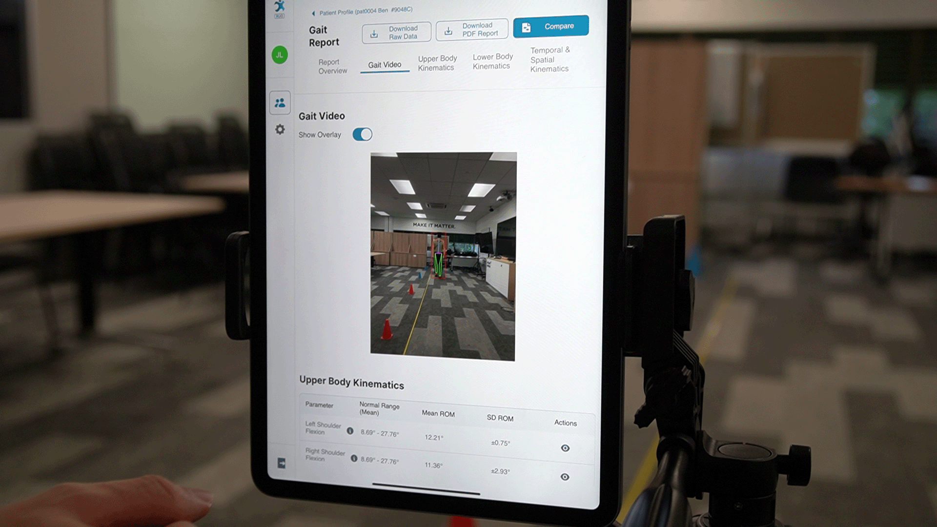 gait analysis copy